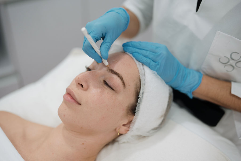 Endolift en el contorno de ojos en Sevilla