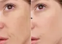 Ácido Ferúlico 1% de la marca Universkin: Resultados