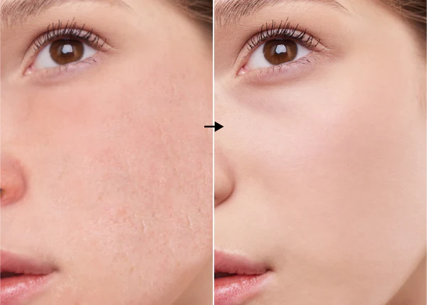 Aloe Vera 5.4 % de la marca Universkin: Resultados