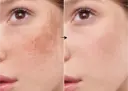 Arbutina 3% de la marca Universkin: Resultados