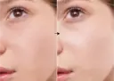 Zinc 5% de la marca Universkin: Resultados