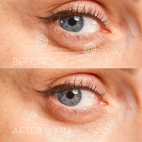 Eye Precision Mask Pack de 6