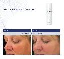 Brightening Complex de la marca Is Clinical: Resultados visibles en apenas 90 dias