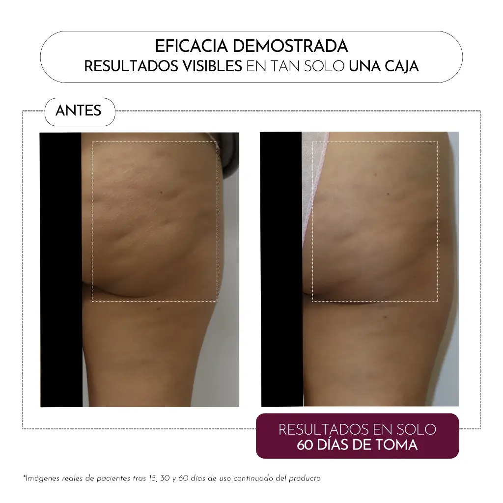 Fórmula Celulox